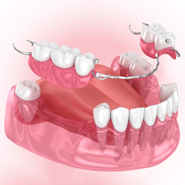 Winter Springs Dentistry Family and Cosmetic Dentistry